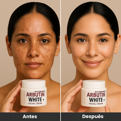 ✨ lleva 3 Arbutin White + 1 Elixir Antiedad de regalo! Dile adiós a las manchas y al acné revela tu verdadera piel 💖